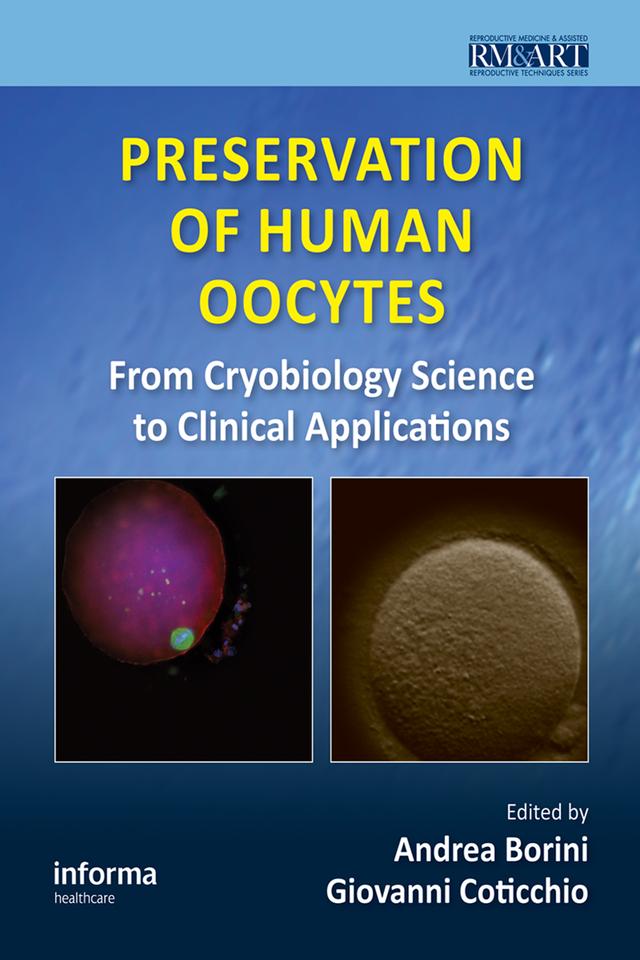 Preservation of Human Oocytes by Andrea Borini, Giovanni Coticchio