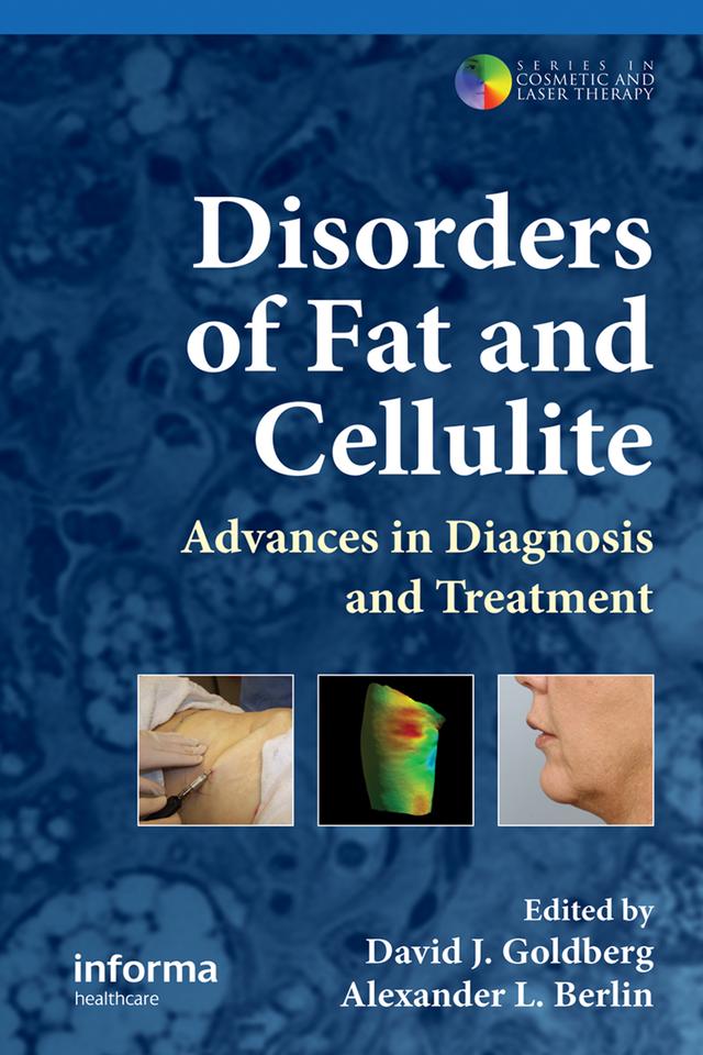 Disorders of Fat and Cellulite by Alexander L. Berlin, David J. Goldberg