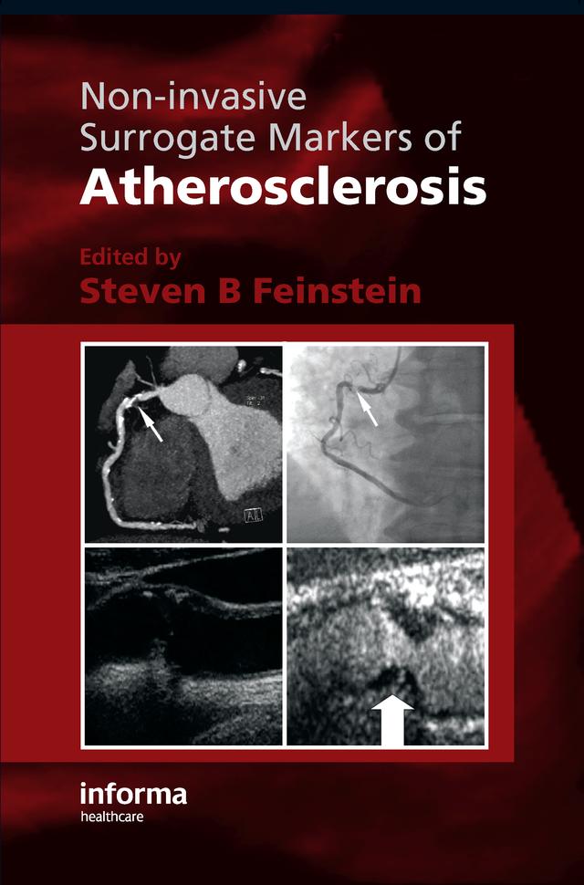 Non-Invasive Surrogate Markers of Atherosclerosis by Steven B. Feinstein