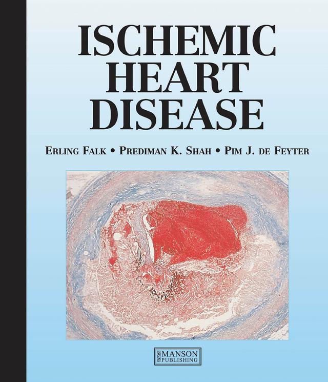 Ischemic Heart Disease by Erling Falk, Pim de Feyter, Prediman Shah