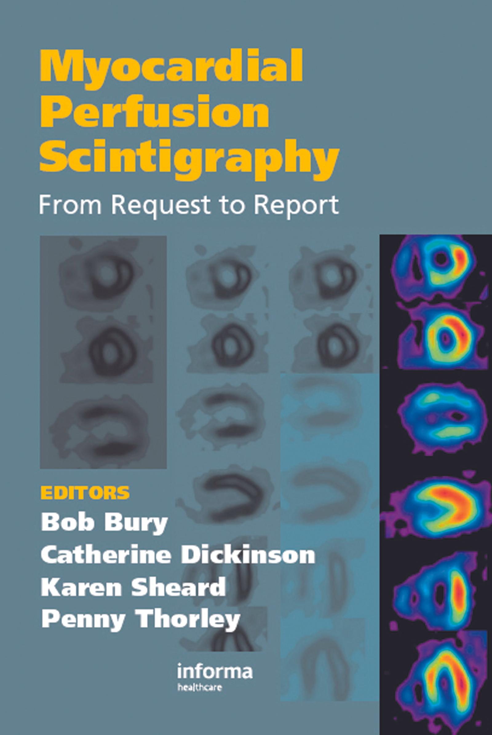 Myocardial Perfusion Scintigraphy