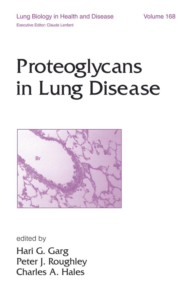 Proteoglycans in Lung Disease by Hari G. Garg