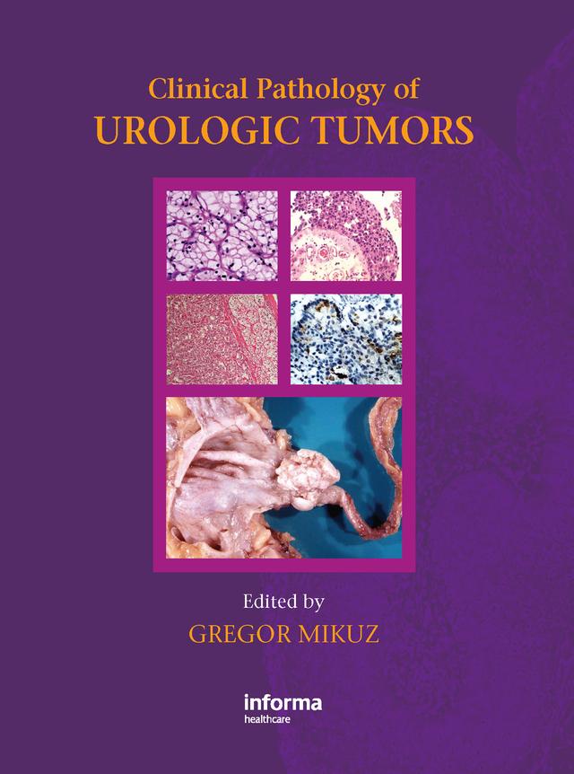 Clinical Pathology of Urological Tumours by Gregor Mikuz