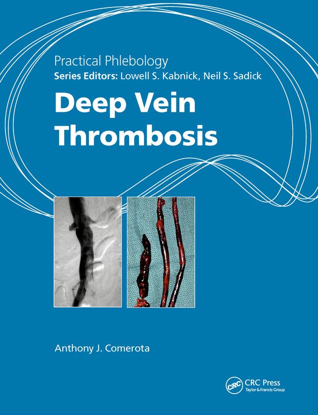 Practical Phlebology by Anthony J. Comerota