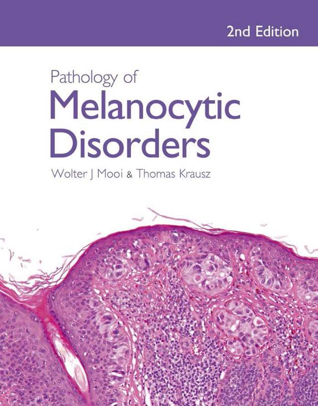 Pathology of Melanocytic Disorders 2ed by Thomas Krausz, Walter Mooi