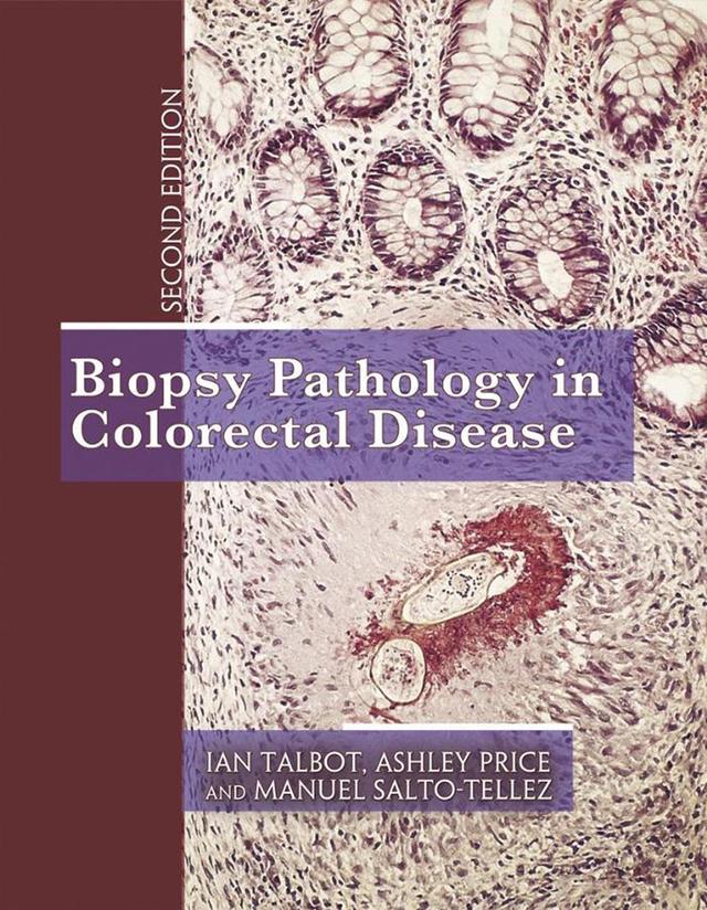 Biopsy Pathology in Colorectal Disease, 2Ed by Ashley Price, Ian Talbot, Manuel Salto-Tellez