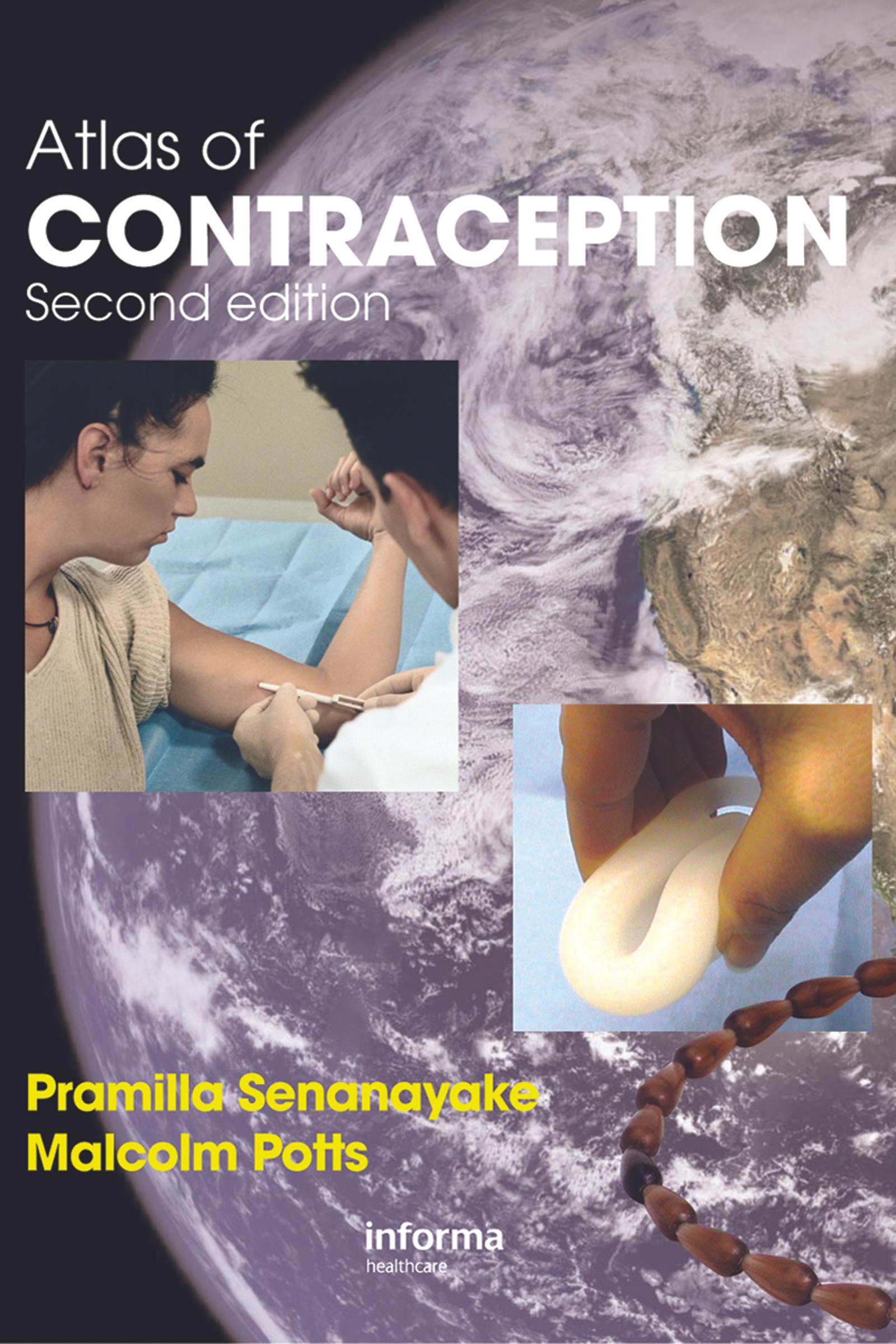 Atlas of Contraception