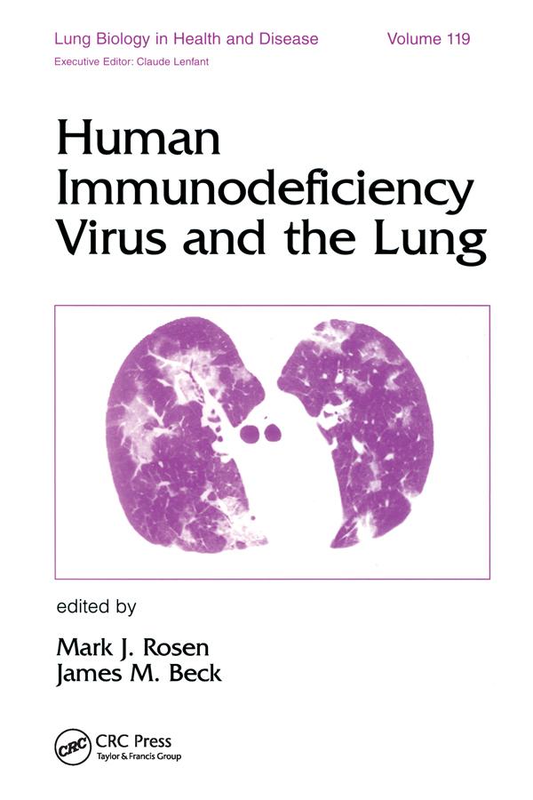 Human Immunodeficiency Virus and the Lung by James M. Beck, Mark J. Rosen