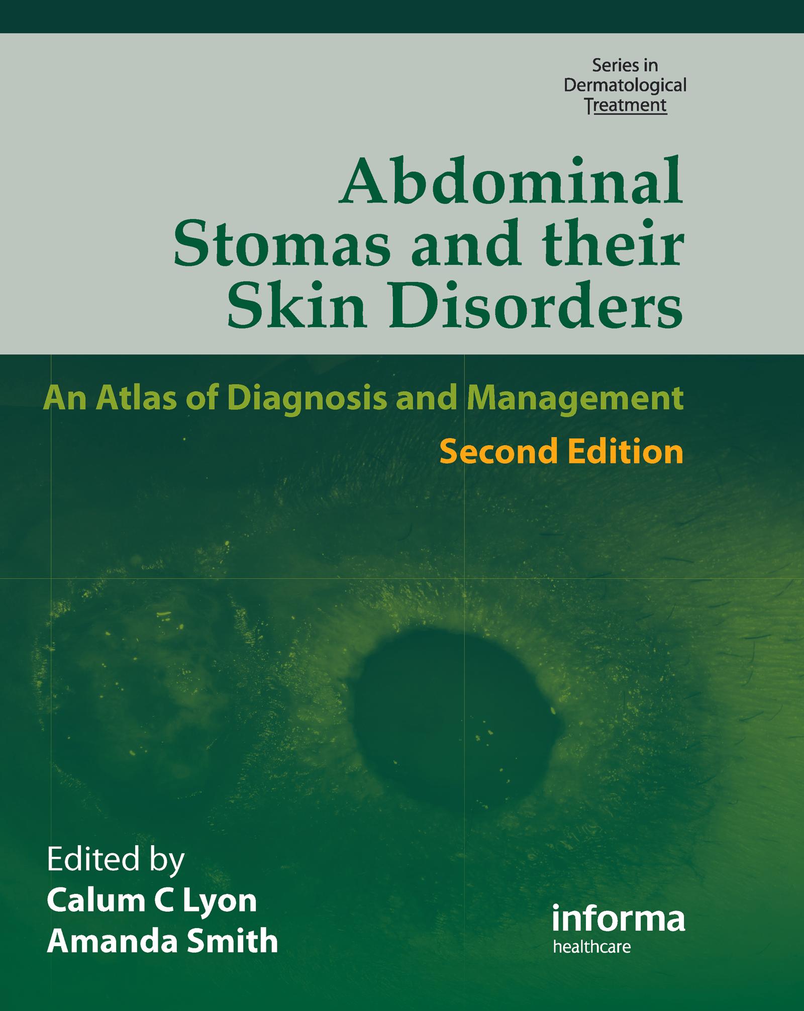 Abdominal Stomas and Their Skin Disorders