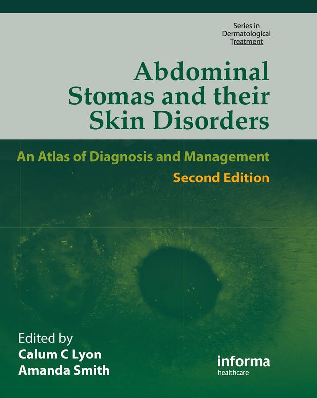 Abdominal Stomas and Their Skin Disorders by Amanda Smith, Callum C. Lyon