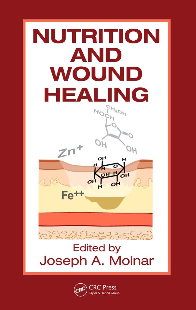 Nutrition and Wound Healing by Joseph A. Molnar MD PhD FACS