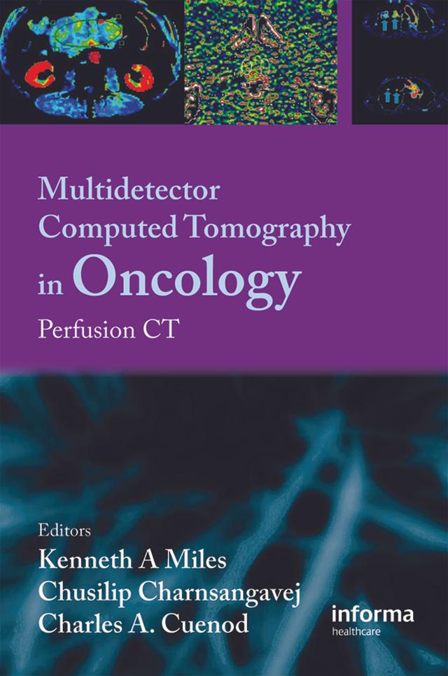 Multi-Detector Computed Tomography in Oncology by C. Charnsangavej, C. Cuenod, Kenneth Miles