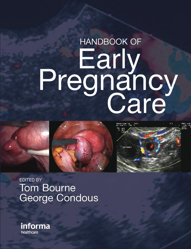 Handbook of Early Pregnancy Care by Thomas H. Bourne