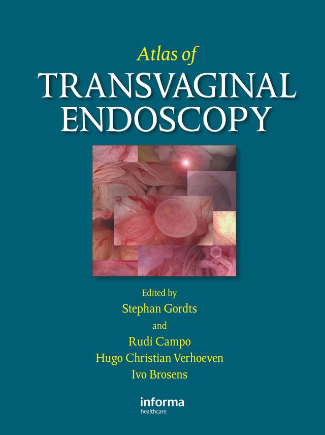 Atlas of Transvaginal Endoscopy by Hugo C. Verhoeven, Ivo Brosens, Rudi Campo, Stephan Gordts