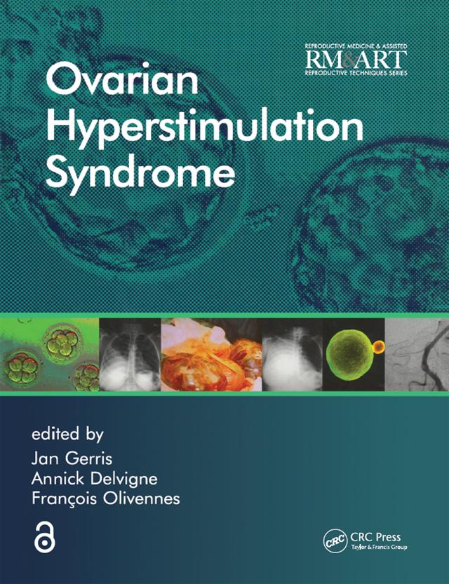 Ovarian Hyperstimulation Syndrome by Annick Delvigne, Francois Olivennes, Jan Gerris
