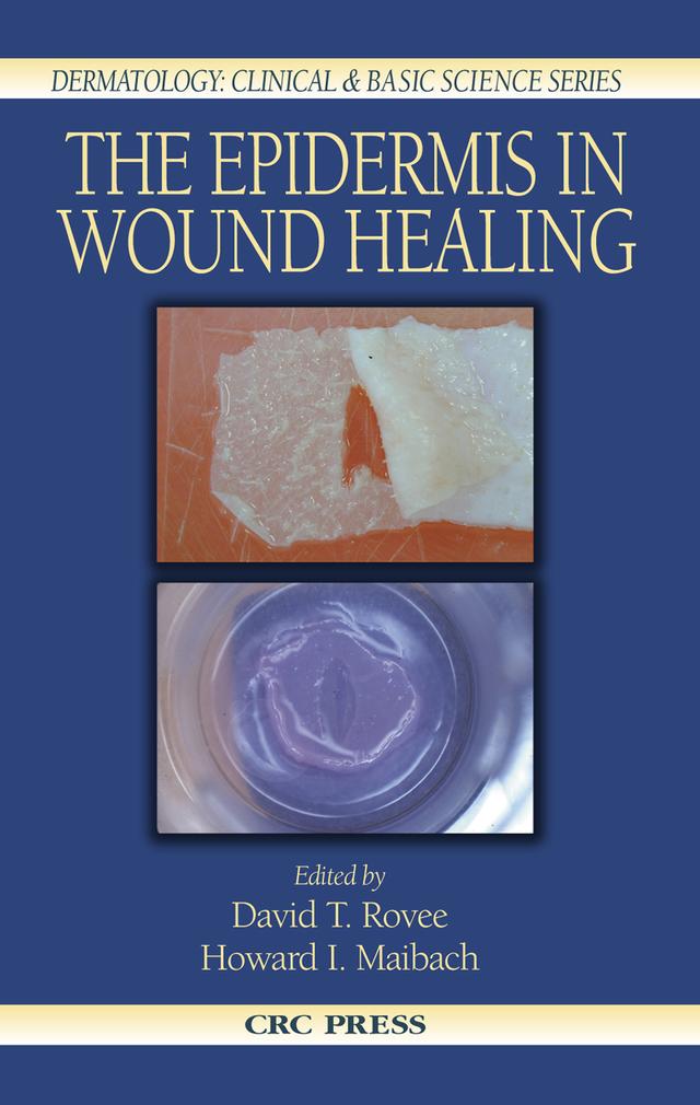 The Epidermis in Wound Healing by David T. Rovee, Howard I. Maibach