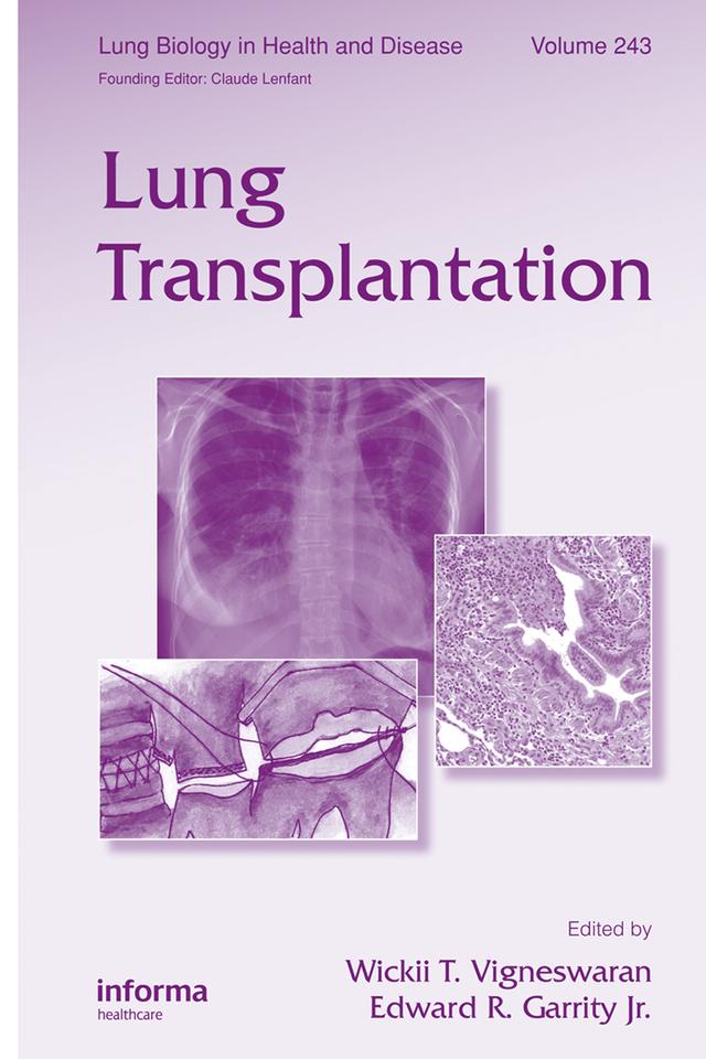 Lung Transplantation by Edward R. Garrity Jr., Wickii Vigneswaran