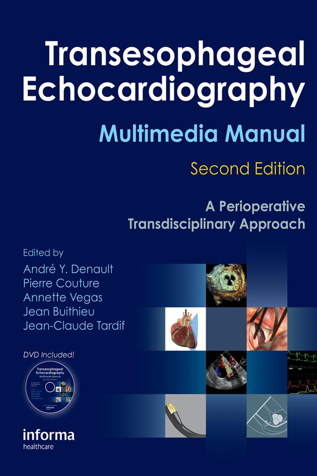 Transesophageal Echocardiography Multimedia Manual by André Denault, Annette Vegas, Jean Buithieu, Jean-Claude Tardif, Pierre Couture