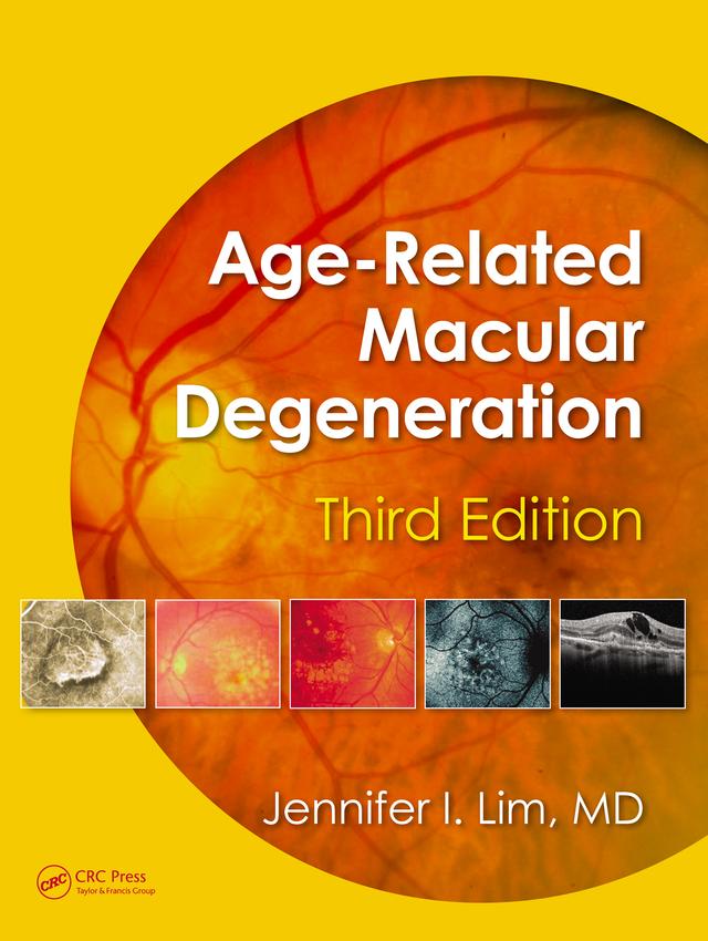 Age-Related Macular Degeneration by Jennifer I. Lim
