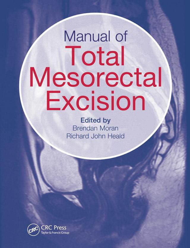 Manual of Total Mesorectal Excision by Brendan Moran, Richard John Heald