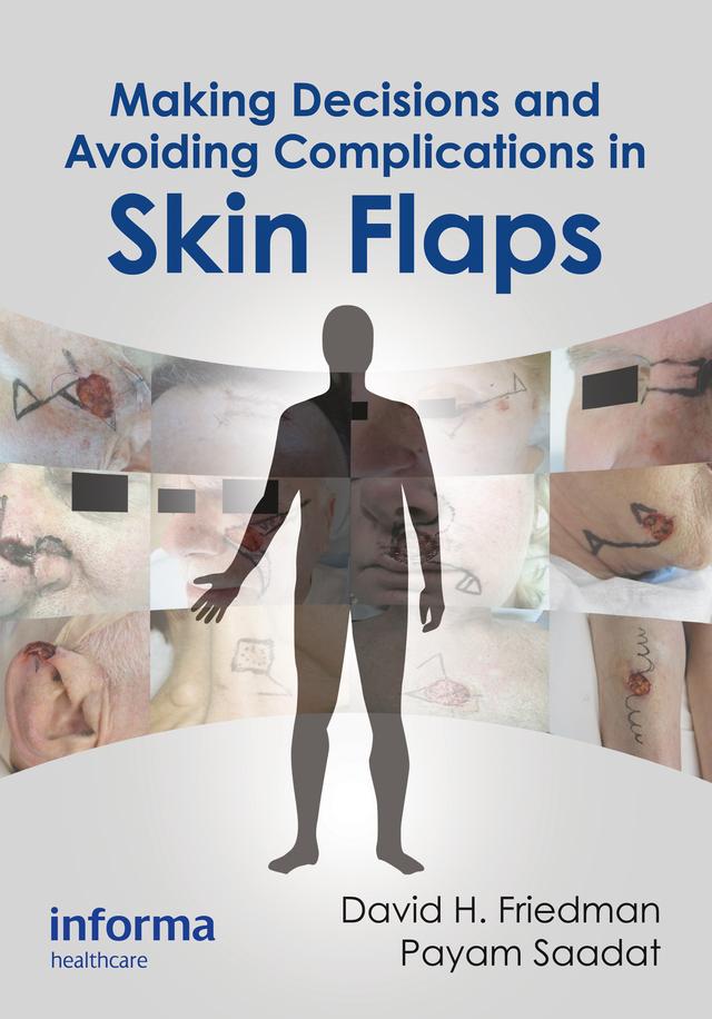 Making Decisions and Avoiding Complications in Skin Flaps by David H. Friedman, Payam Saadat