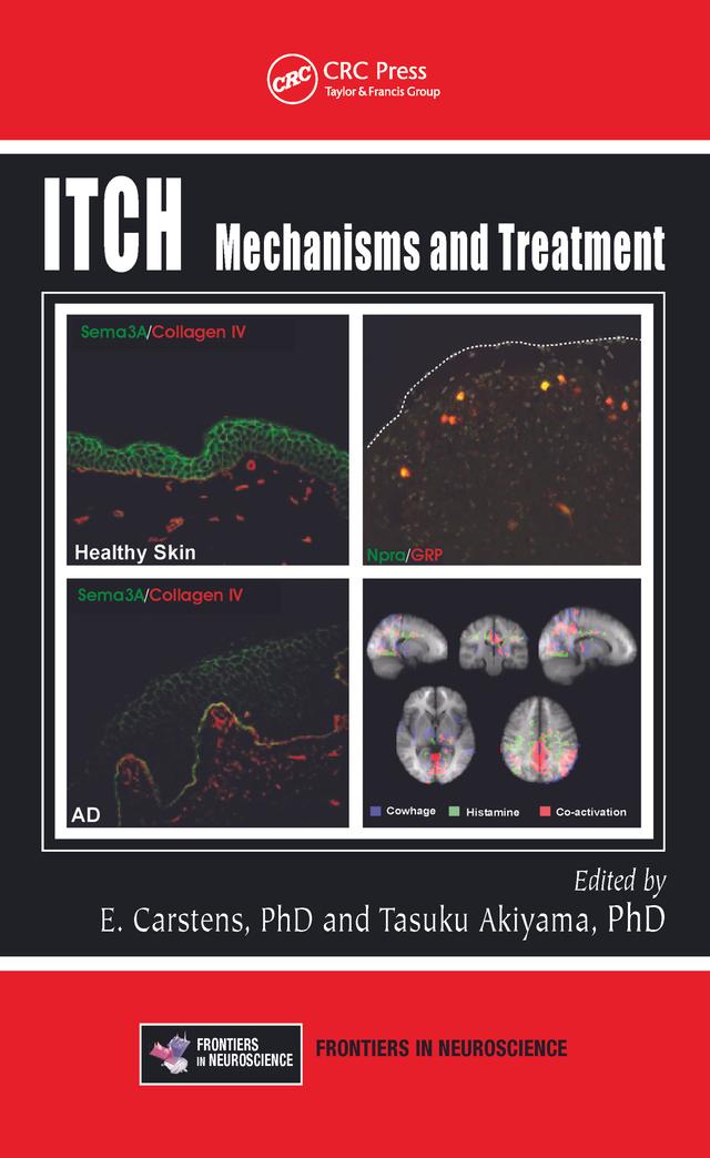 Itch by E. Carstens, Tasuku Akiyama