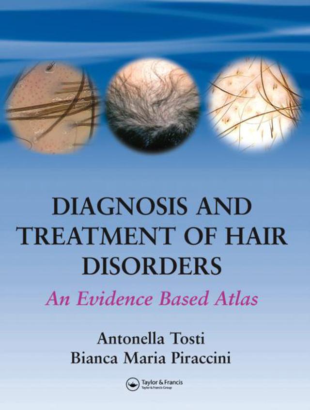 Diagnosis and Treatment of Hair Disorders by Antonella Tosti, Bianca Maria Piraccini