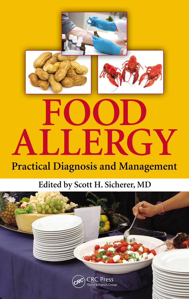 Food Allergy by Scott H. Sicherer