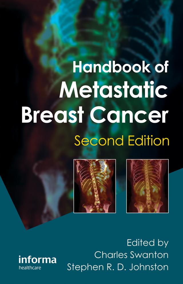 Handbook of Metastatic Breast Cancer by Charles Swanton, Stephen R. D. Johnston