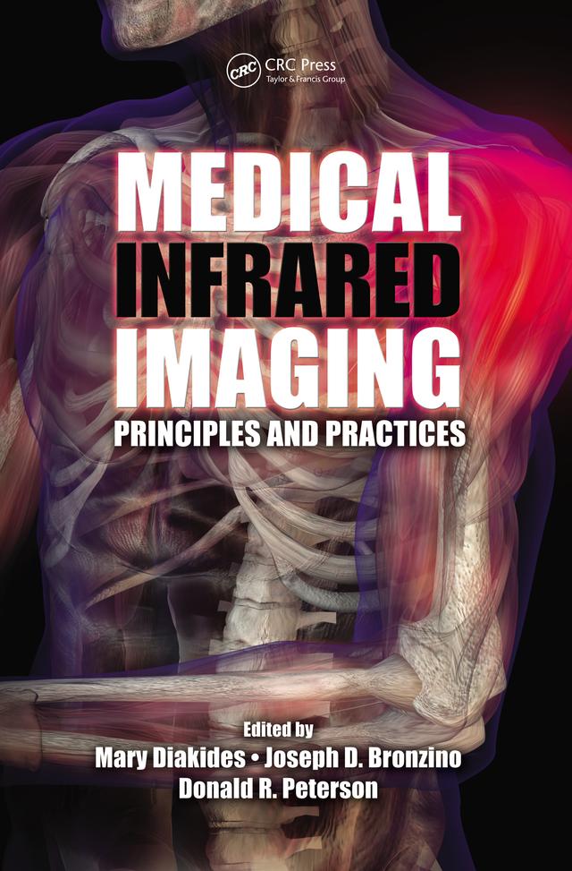 Medical Infrared Imaging by Donald R. Peterson, Joseph D. Bronzino, Mary Diakides