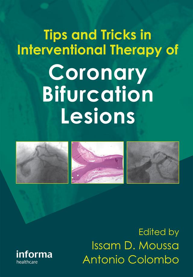 Tips and Tricks in Interventional Therapy of Coronary Bifurcation Lesions by Antonio Colombo, Issam Moussa