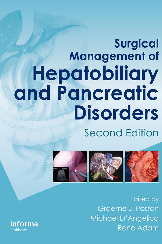 Surgical Management of Hepatobiliary and Pancreatic Disorders by Graeme J. Poston, Michael D’Angelica, René Adam