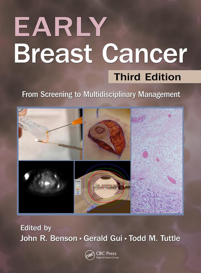 Early Breast Cancer by Gerald P.H. Gui, John R Benson, Todd Tuttle