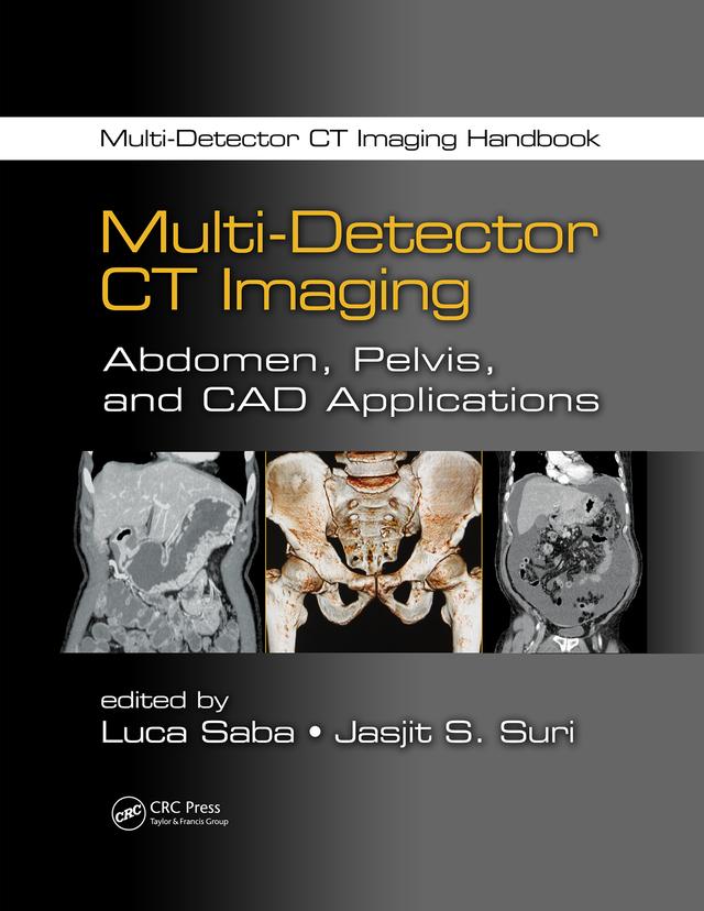 Multi-Detector CT Imaging by Jasjit S. Suri, Luca Saba