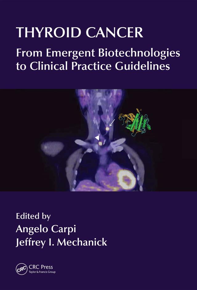 Thyroid Cancer by Angelo Carpi, Jeffrey I Mechanick