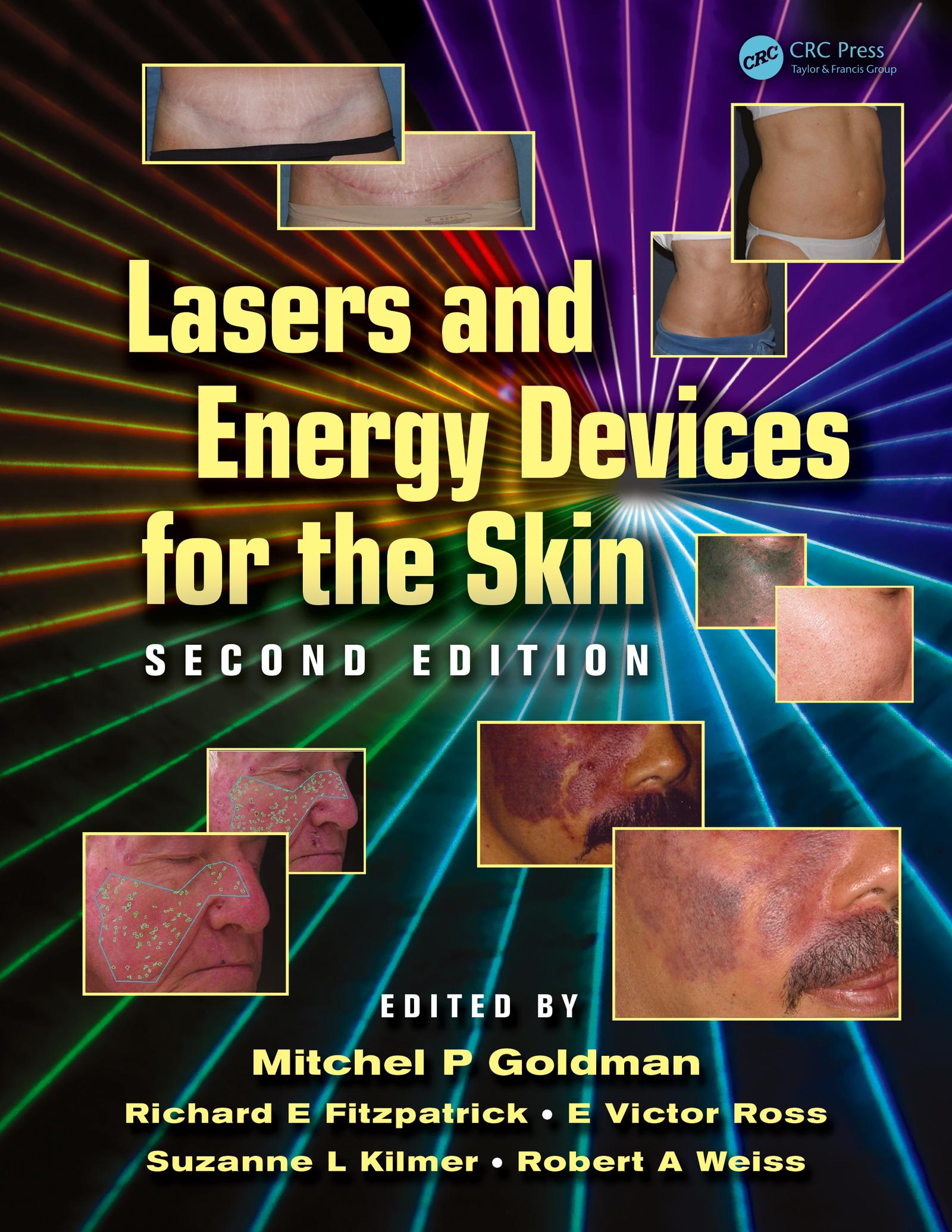 Lasers and Energy Devices for the Skin