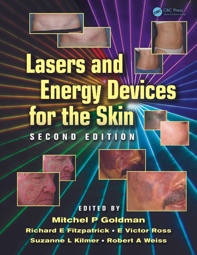 Lasers and Energy Devices for the Skin by E. Victor Ross, Mitchel P. Goldman, Richard E. Fitzpatrick, Robert A. Weiss, Suzanne L. Kilmer
