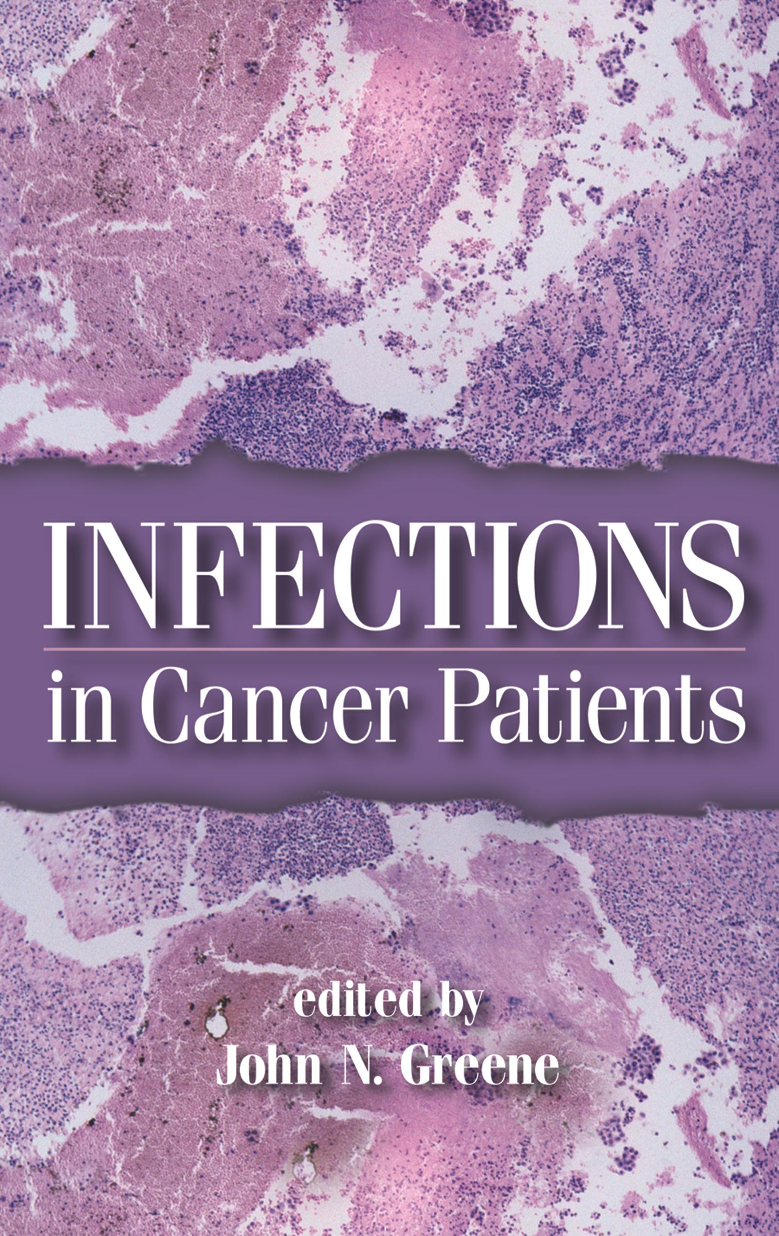 Infections in Cancer Patients