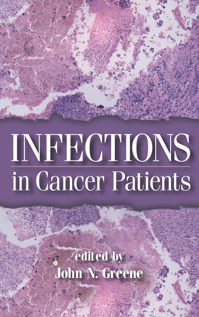 Infections in Cancer Patients by John N. Greene