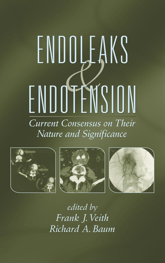 Endoleaks and Endotension by Frank J. Veith, Richard Baum