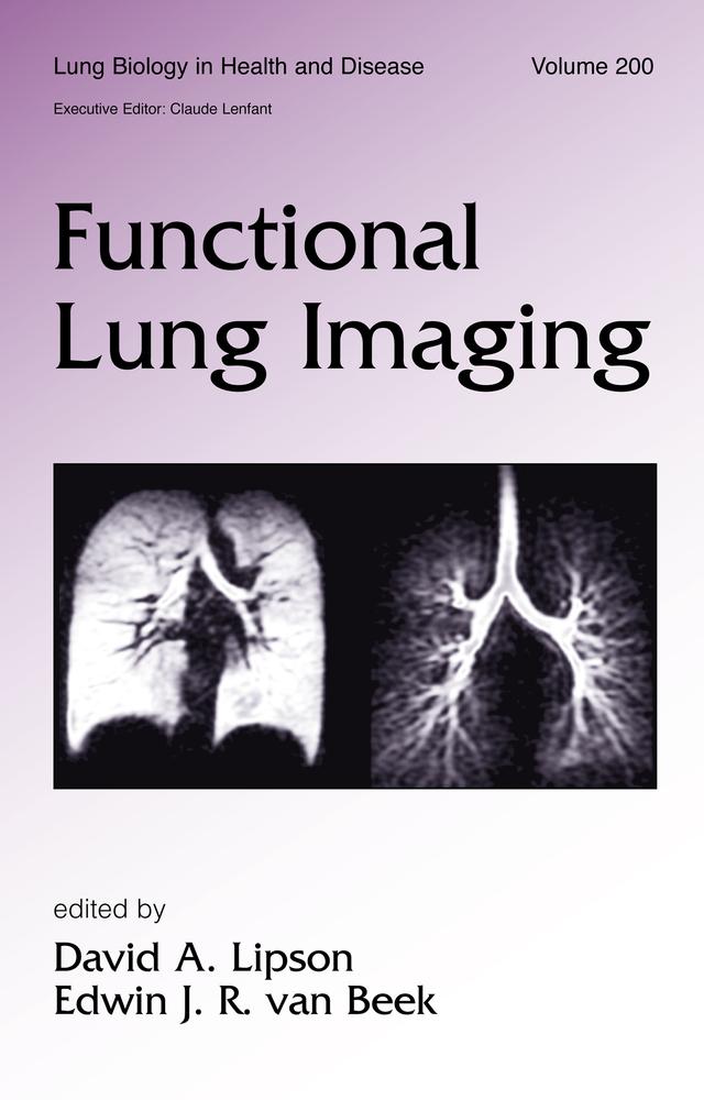 Functional Lung Imaging by David Lipson, Edwin van Beek