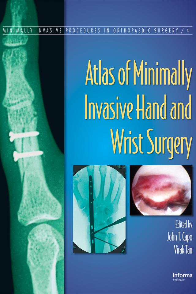 Atlas of Minimally Invasive Hand and Wrist Surgery by John T. Capo, Virak Tan