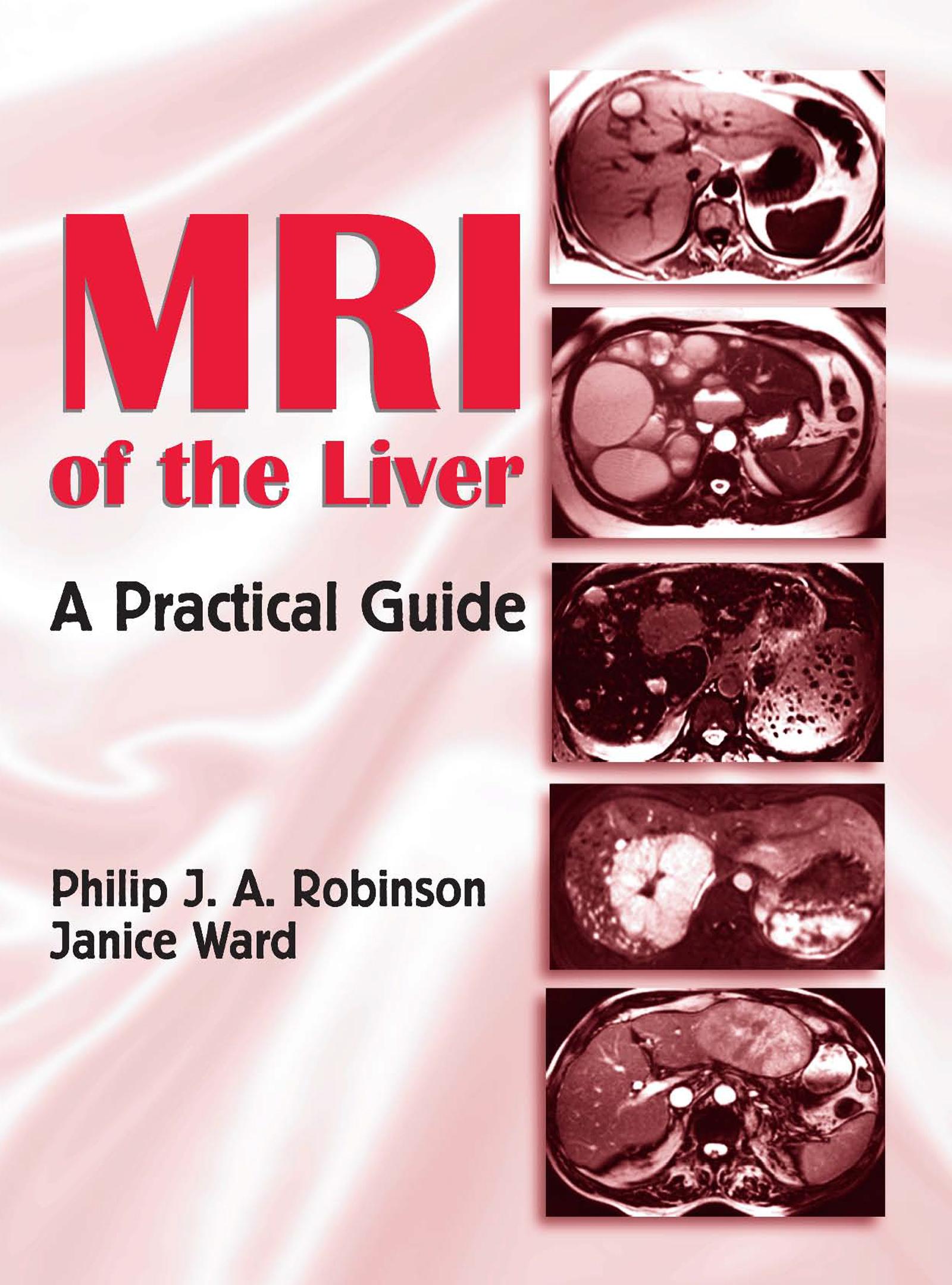 MRI of the Liver