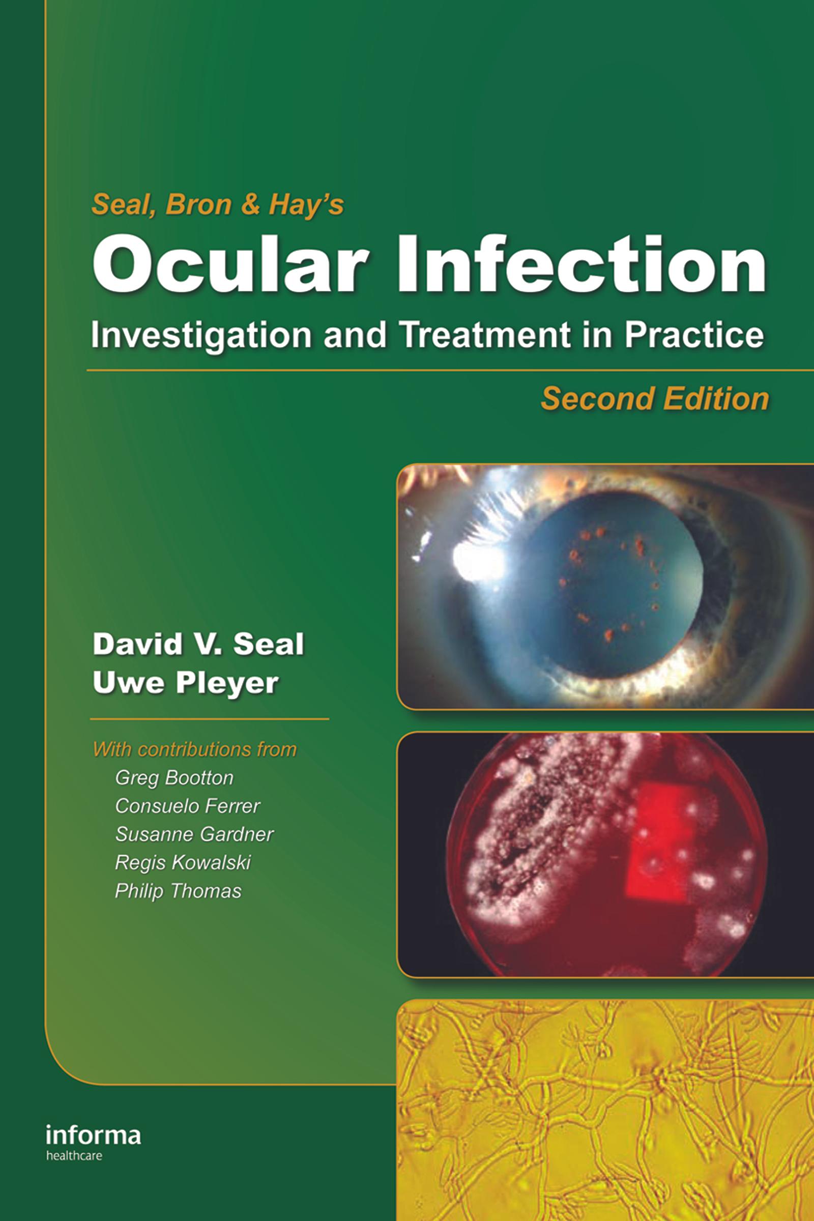 Ocular Infection
