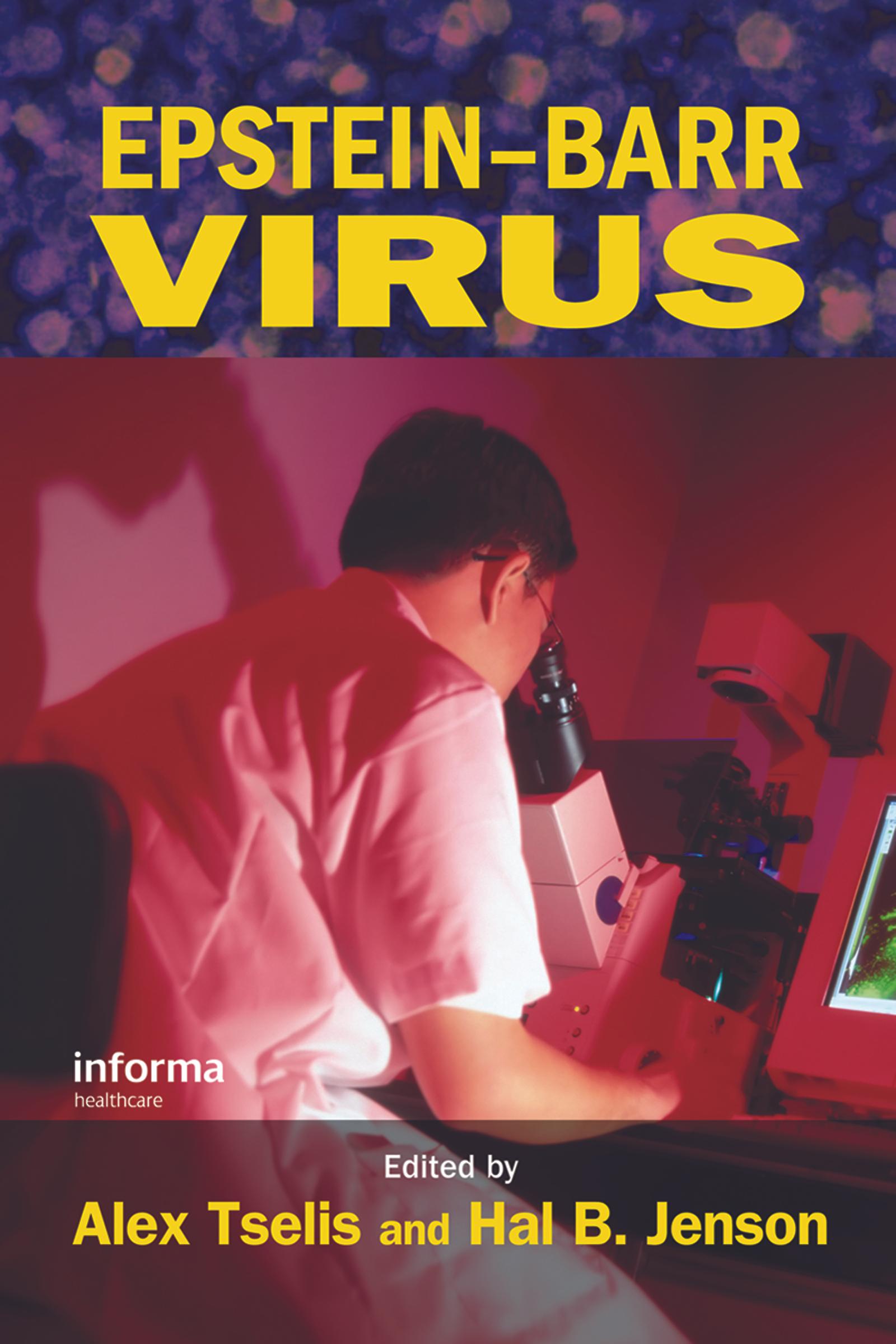 Epstein-Barr Virus