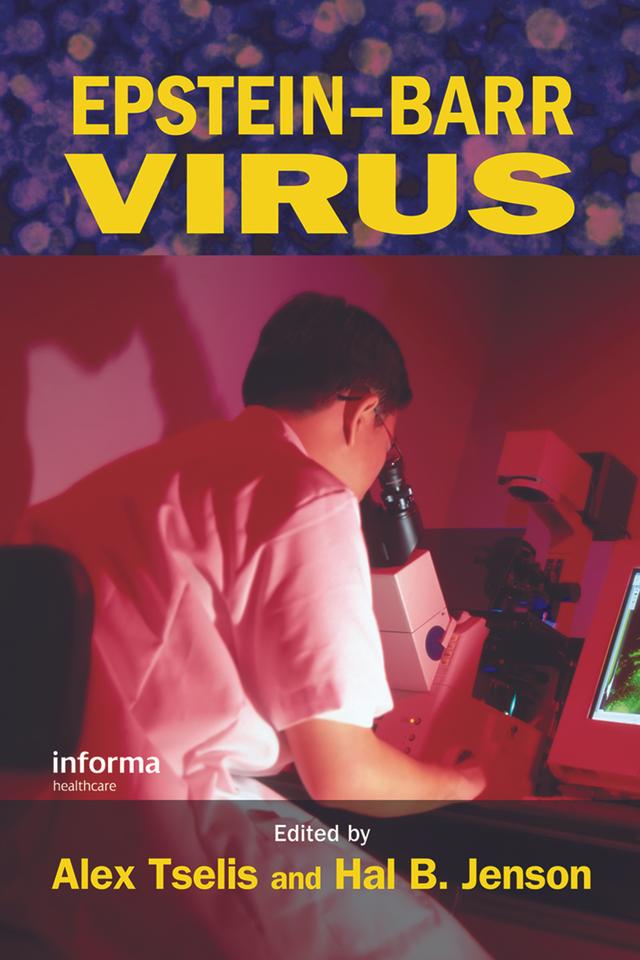 Epstein-Barr Virus by Alex Tselis, Hal B. Jenson