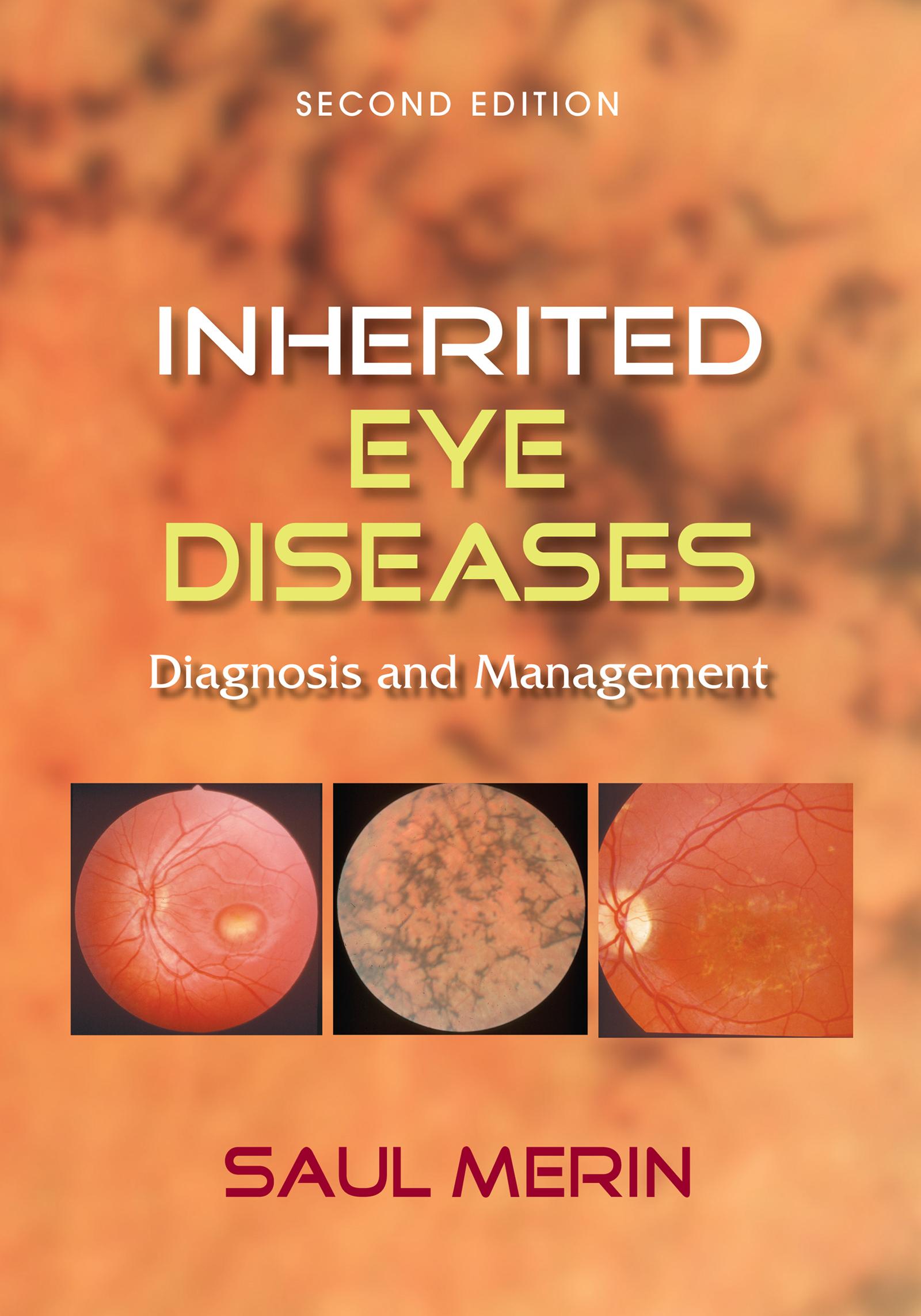 Inherited Eye Diseases