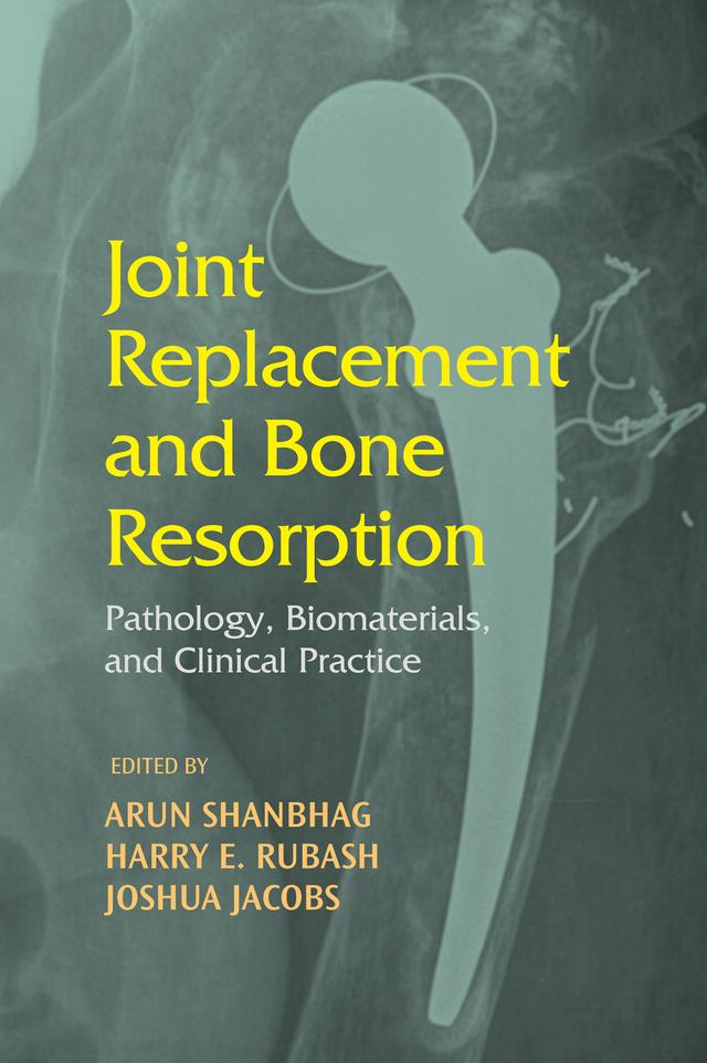 Joint Replacement and Bone Resorption by Arun Shanbhag, Harry E. Rubash, Joshua J. Jacobs