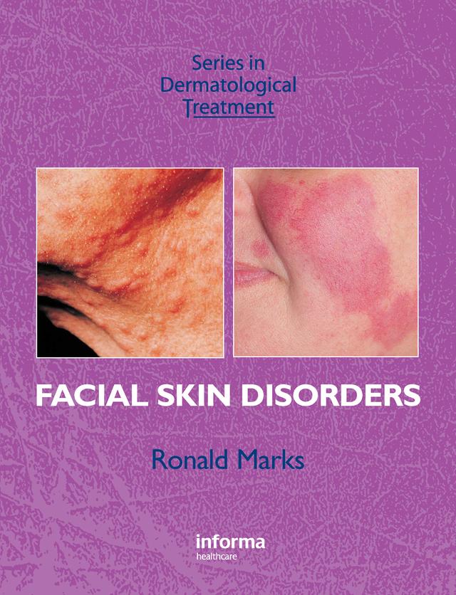 Facial Skin Disorders by Ronald Marks