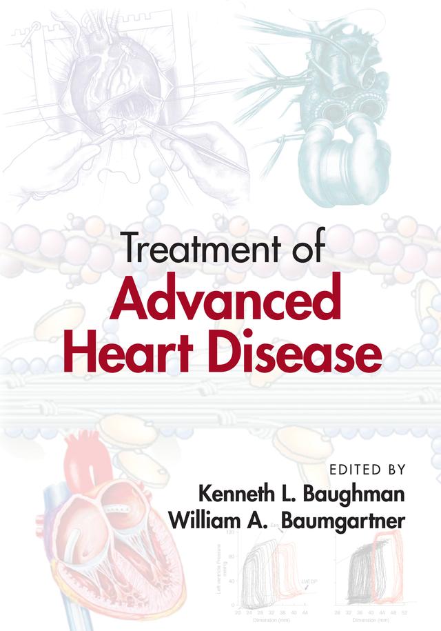 Treatment of Advanced Heart Disease by Kenneth L. Baughman, William A. Baumgartner